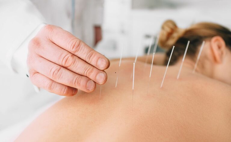 Medicina tradițională chineză &icirc;n endometrioză: plante, acupunctură, ce arată studiile și ce riscuri există