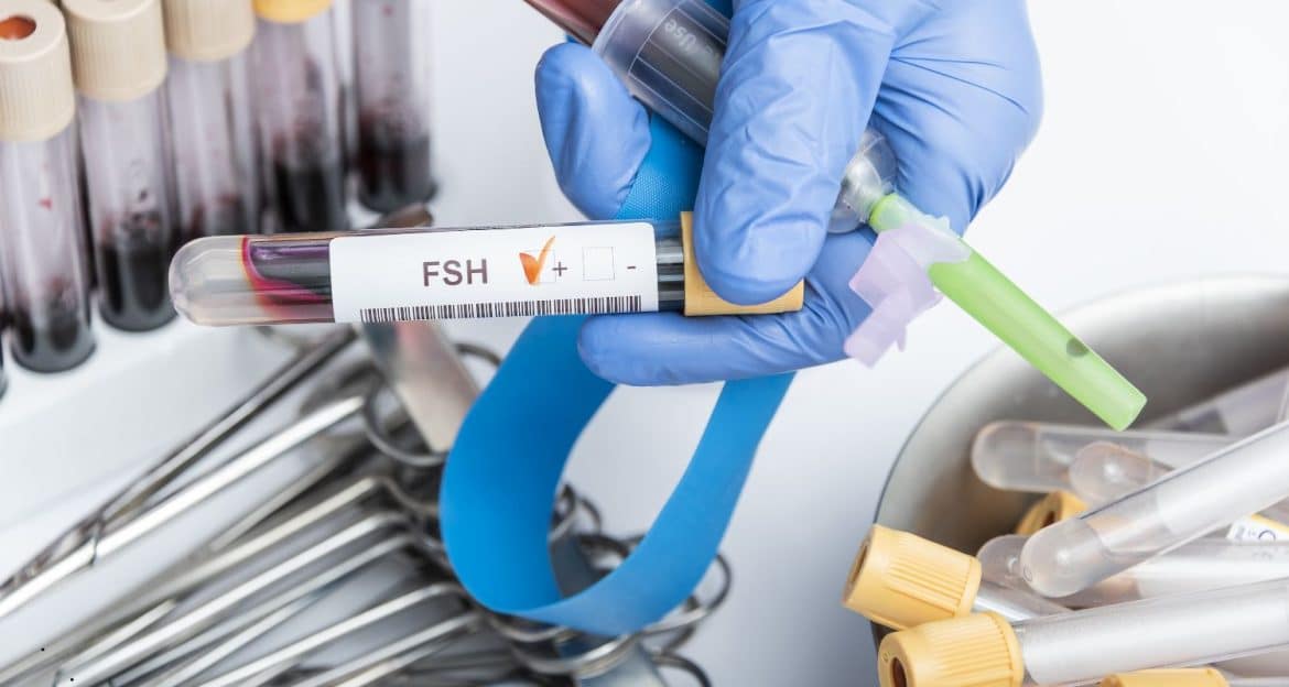 FSH crescut — ce înseamnă pentru rezerva ovariană și fertilitate