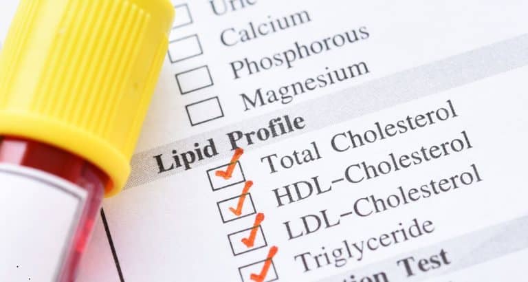 Profilul lipidic complet &mdash; dincolo de colesterol total