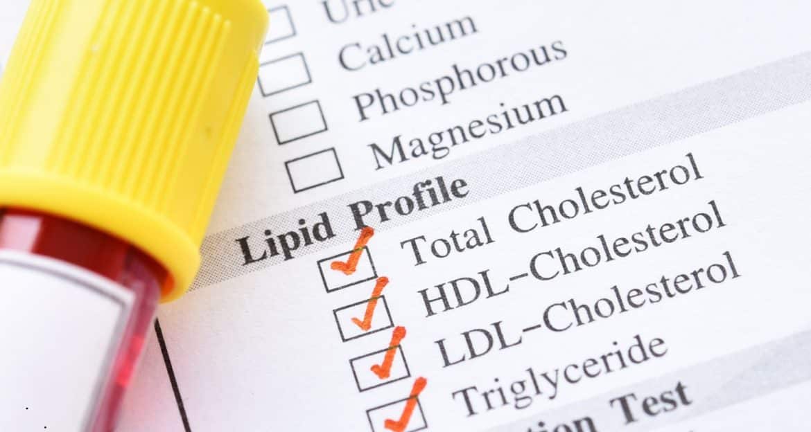 Profilul lipidic complet — dincolo de colesterol total