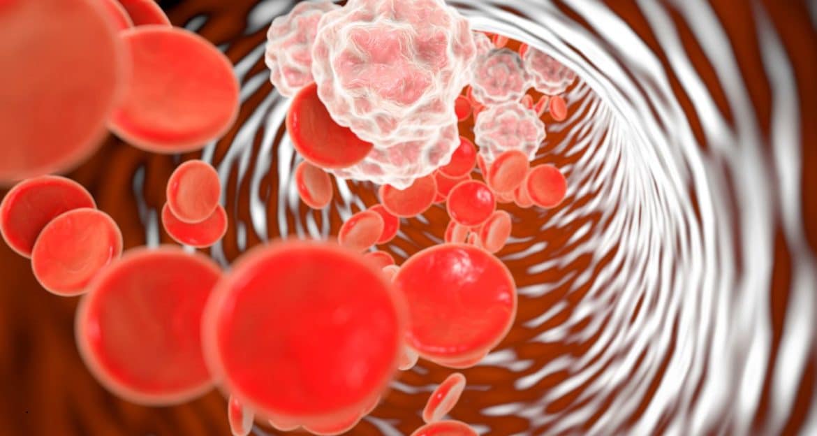 tlr4-receptor-bacterii-dieta-inflamatie-metabolica