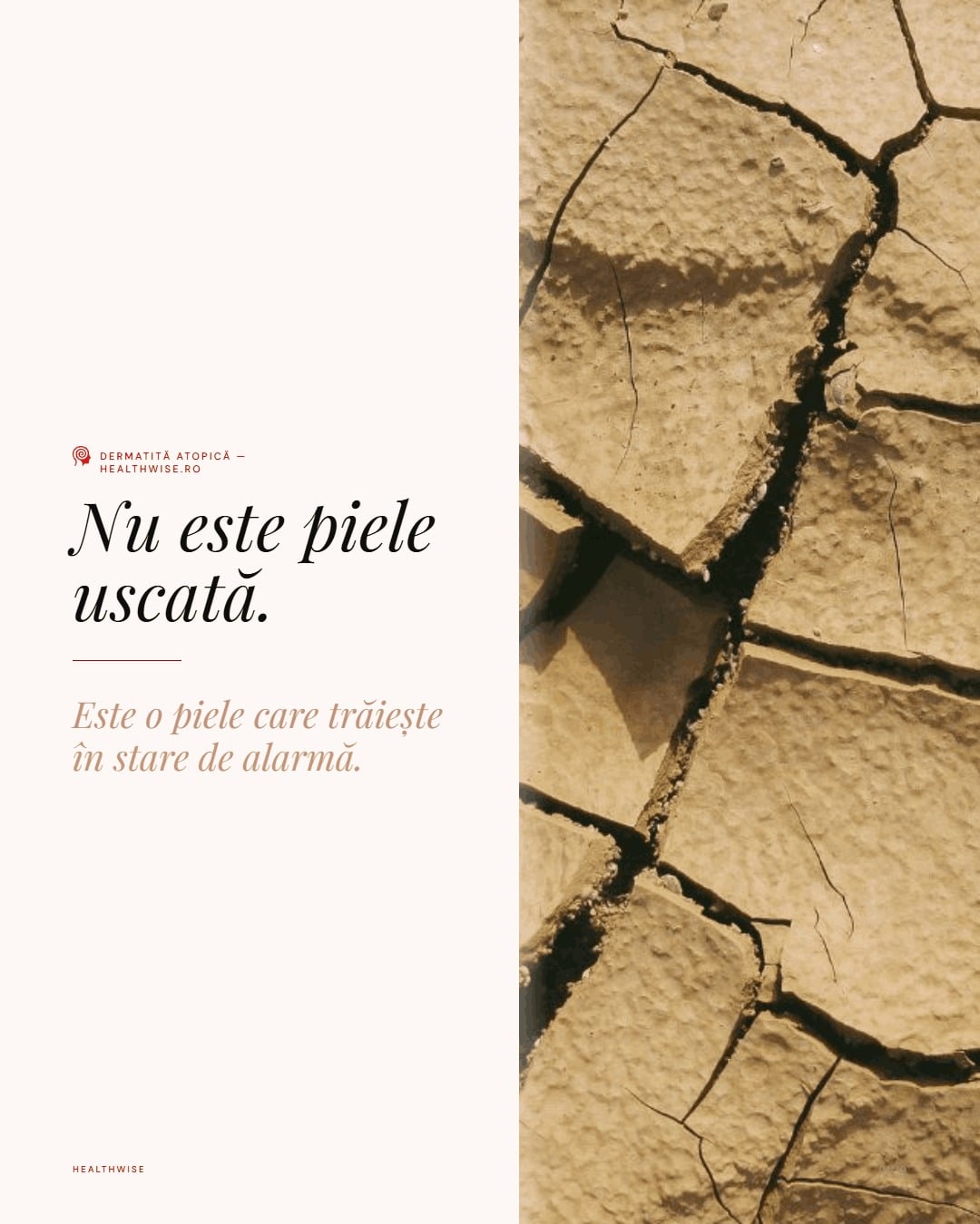 Dermatita atopica la adulti: bariera, imunitate, prurit si arsenal terapeutic 2025 — Carousel vizual Healthwise