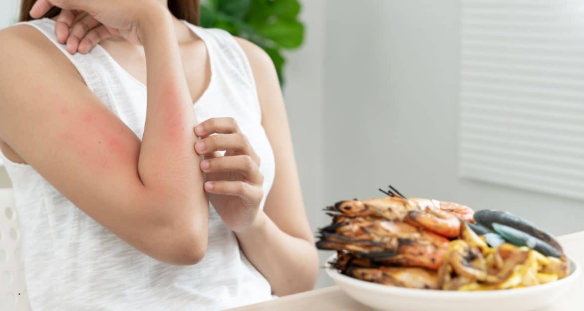 Alergii alimentare: reacția nu pornește din aliment, ci din felul în care sistemul imun îl interpretează