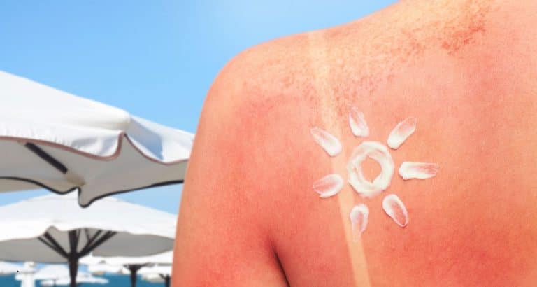 Bemotrizinol: filtrul UV care schimbă piața cremelor solare din SUA după peste 20 de ani