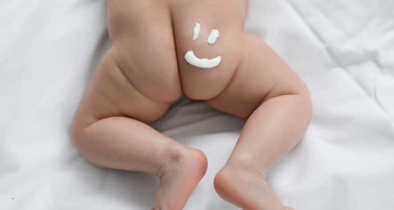 Dermatita de scutec nu este o infecție care apare &mdash; este o barieră care cedează