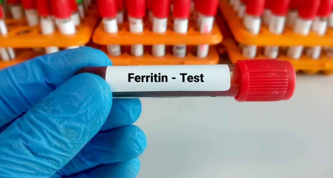 Feritina scăzută nu începe de la 15: ce schimbă noile praguri de diagnostic