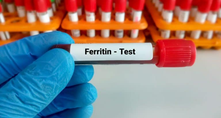 Feritina scăzută nu &icirc;ncepe de la 15: ce schimbă noile praguri de diagnostic