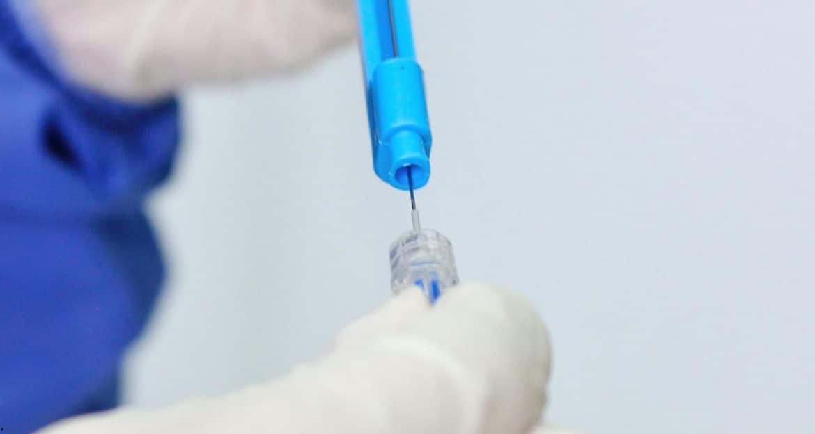 Hiperprolactinemia poate opri ovulația fără să existe o tumoră hipofizară