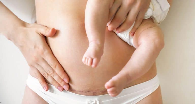 Nașterea naturală vs cezariana &mdash; ce spune medicina bazată pe dovezi