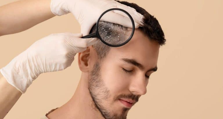 Piroctone olamine nu exfoliază mătreața &mdash; schimbă echilibrul microbian care o produce