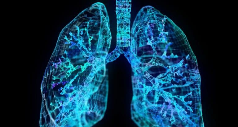Scor CURB-65: c&acirc;nd pneumonia comunitară cere un nivel mai mare de &icirc;ngrijire