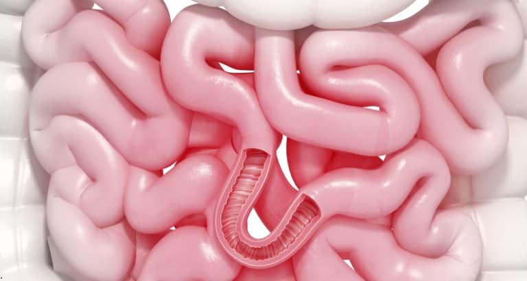 Transplantul fecal &icirc;n colonul iritabil: microbiota donorului nu a depășit placebo &icirc;n studiul REFIT2
