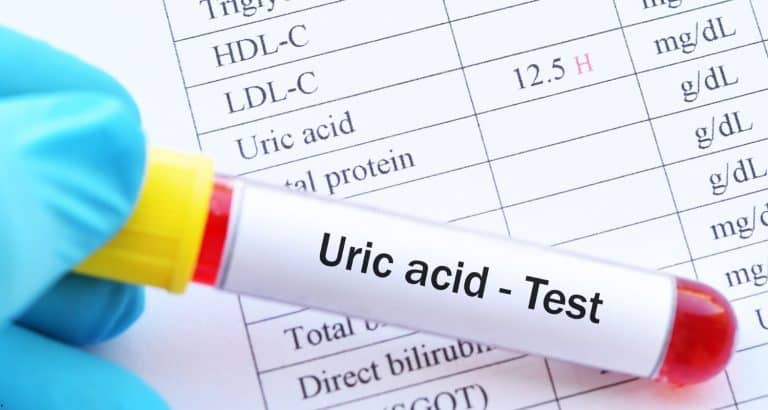 Acid uric crescut: cauze, analize și c&acirc;nd devine o problemă medicală