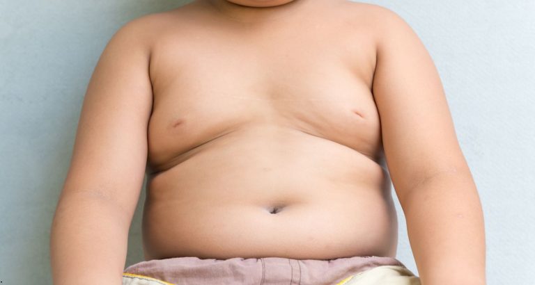 Obezitatea la copii și adolescenți: ce recomandă primele ghiduri OMS de tratament