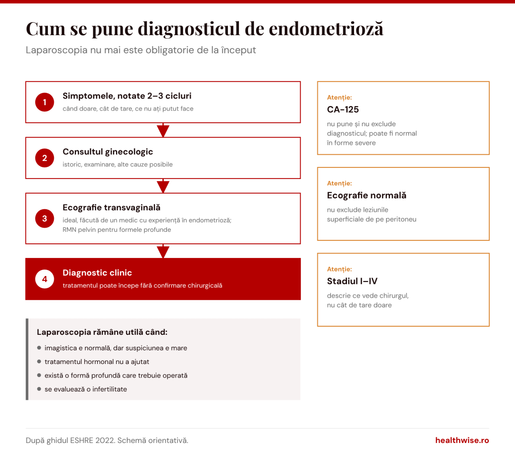 Cum se pune diagnosticul de endometrioză: simptome, consult, ecografie transvaginală, diagnostic clinic; c&acirc;nd răm&acirc;ne utilă laparoscopia