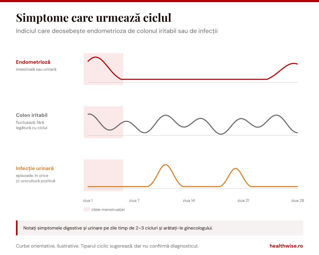 Simptomele digestive și urinare din endometrioză urmează ciclul menstrual, spre deosebire de colonul iritabil sau de infecțiile urinare